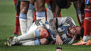 La impactante imagen de la rodilla de Messi tras una fuerte patada