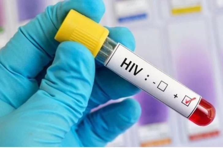 Tres de cada diez diagnósticos de HIV llegan en forma tardía