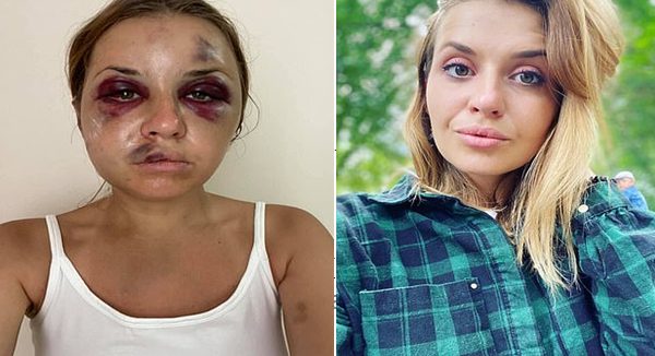 La molieron a golpes tras resistirse a ser violada frente a su hijito en un tren