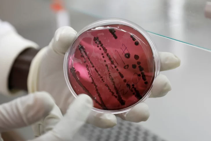 Un nuevo virus letal similar al Ébola enciende alarma tras un brote en Bolivia