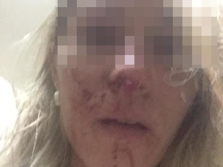 Denunció que su ex le pegó y la obligó a tener relaciones: “Me ahogaba con la sangre”