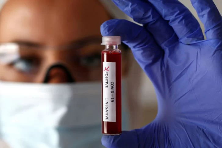 Detectan el tipo de sangre con menos probabilidad de contagiarse de coronavirus