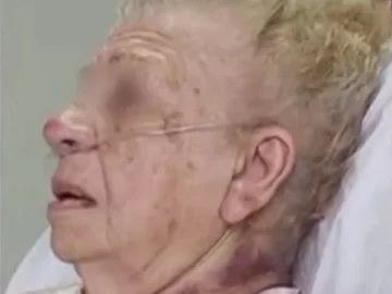 Jubilada de 93 años terminó grave por un terrible asalto