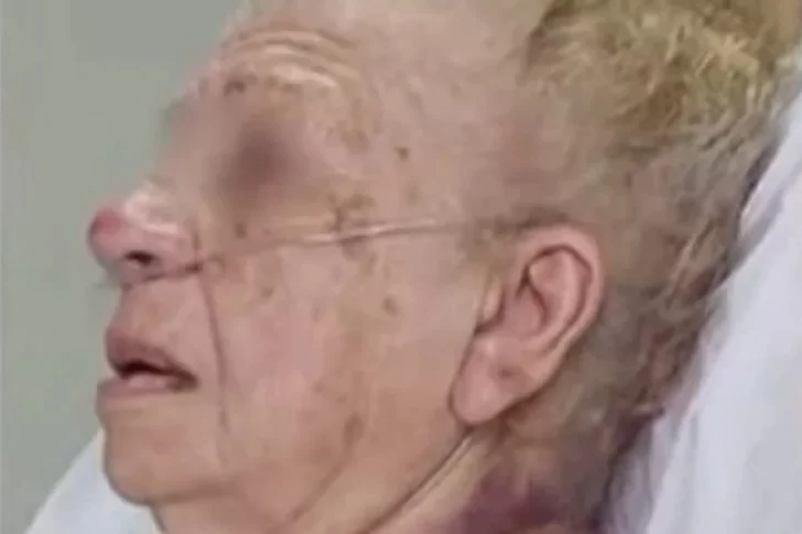 Jubilada de 93 años terminó grave por un terrible asalto