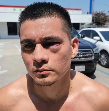 Un corte dejó a Maidana sin pelea titular