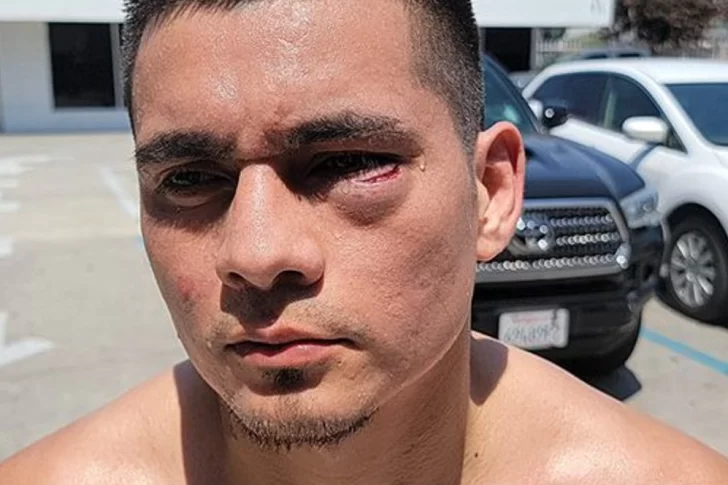 Un corte dejó a Maidana sin pelea titular