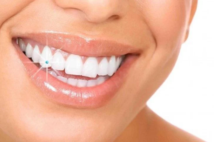 ¿Qué es el piercing dental?