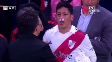 Aliendro sufrió un tremendo golpe y rompió en llanto al tener que salir del Superclásico