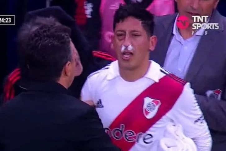 Aliendro sufrió un tremendo golpe y rompió en llanto al tener que salir del Superclásico