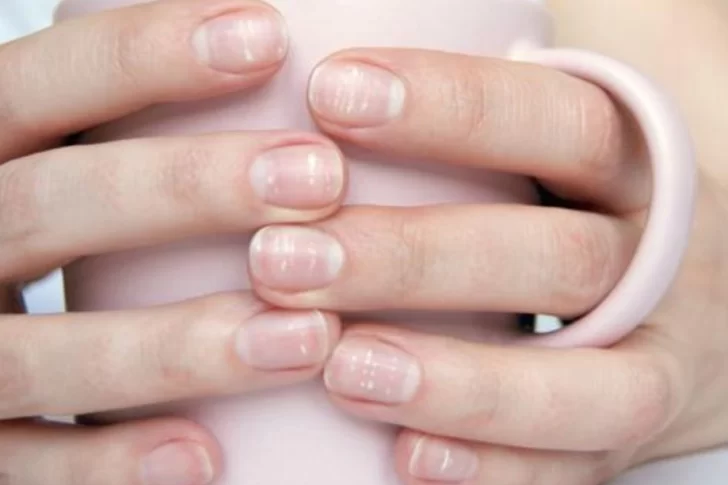 Por qué aparecen puntitos blancos o rayas en las uñas