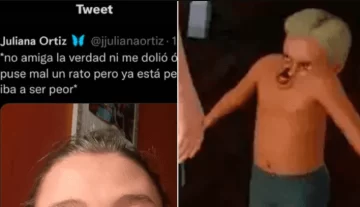 Tuvo un brote de alergia, se le deformó la cara y una amiga la hizo meme