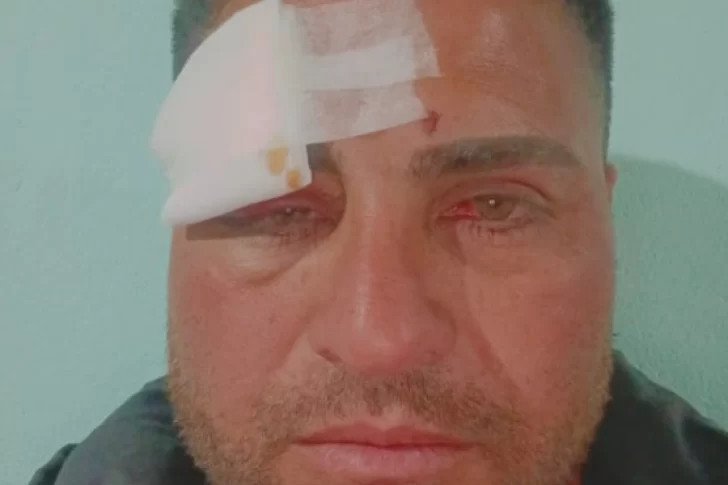 Agredieron brutalmente a un jugador de fútbol en medio de una cancha sanjuanina