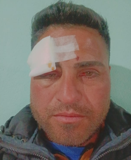 Agredieron brutalmente a un jugador de fútbol en medio de una cancha sanjuanina