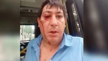 Lo atacaron a piedrazos por no dejar subir a una chica al colectivo que iba lleno