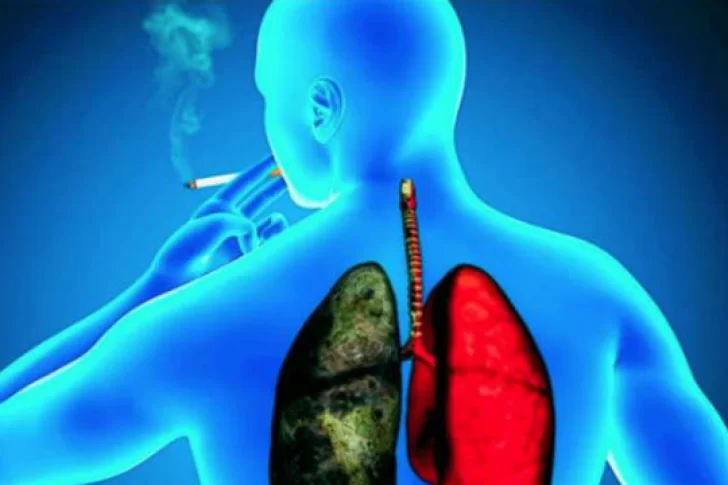 Los pacientes con cáncer de pulmón pueden vivir más con inmunoterapia