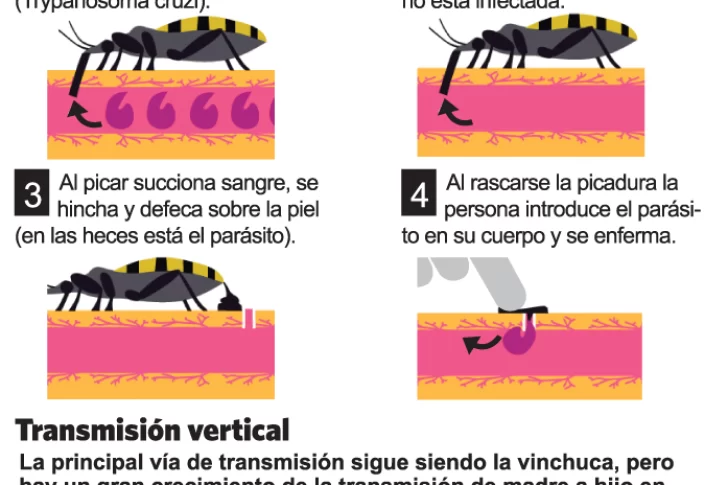 La vinchuca evita alimentarse si la piel que quiere picar tiene sal