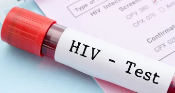 Una argentina con HIV logró controlar la infección luego de 12 años sin tratamiento