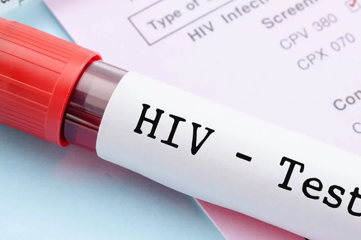 Detectaron 102 casos de HIV en el último año, una cifra mayor a las de otros periodos