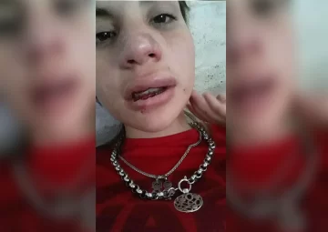 Una joven sufrió una brutal golpiza de su ex, quien salió hace tres meses del Penal