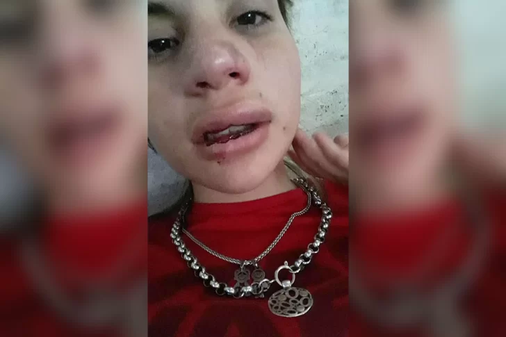 Una joven sufrió una brutal golpiza de su ex, quien salió hace tres meses del Penal