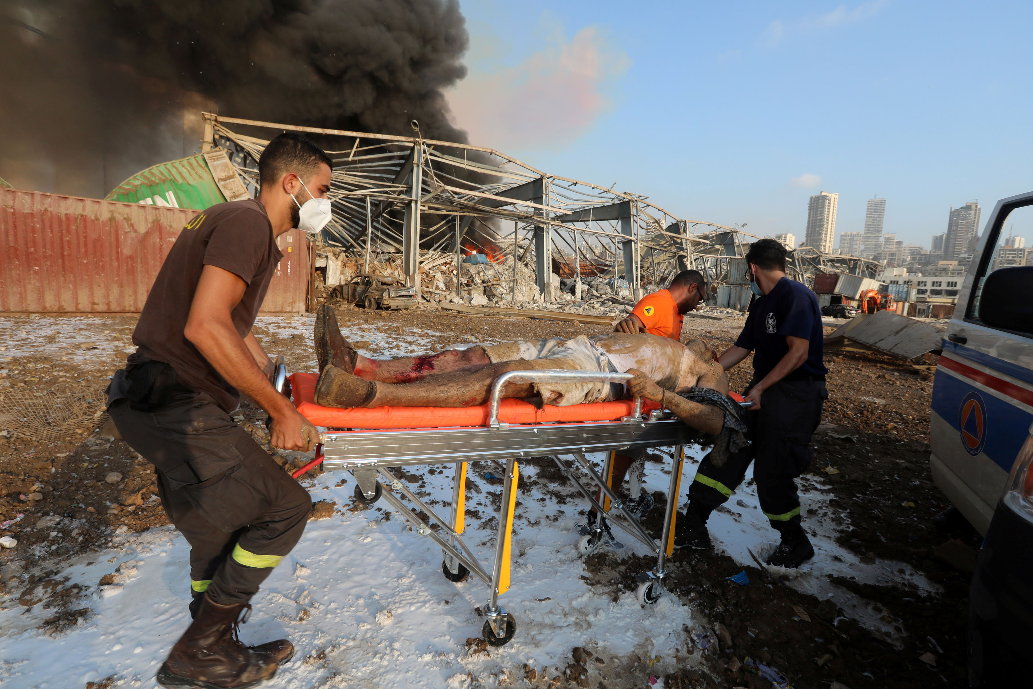 SENSITIVE MATERIAL. THIS IMAGE MAY OFFEND OR DISTURB. An injured man is transported on a stretcher following an explosion in Beirut, Lebanon August 4, 2020. REUTERS/Mohamed Azakir-SMOUT